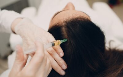 Mezoterapia skóry głowy – na czym polega ta metoda?