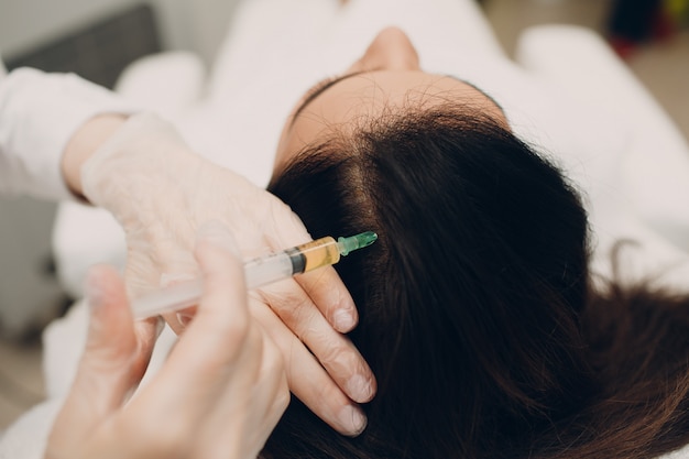 Mezoterapia skóry głowy – na czym polega ta metoda?