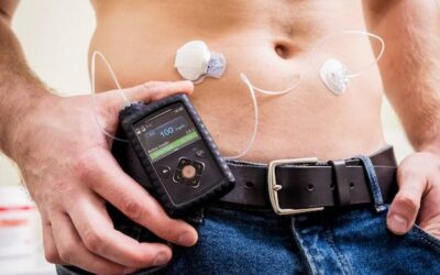 Czy elektrostymulator mięśni brzucha naprawdę pomaga w treningu?